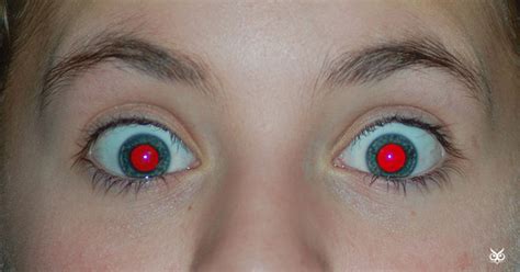 I'm assuming that that's normal. The Interesting Reason Why Our Eyes Get Red In Photos - I ...