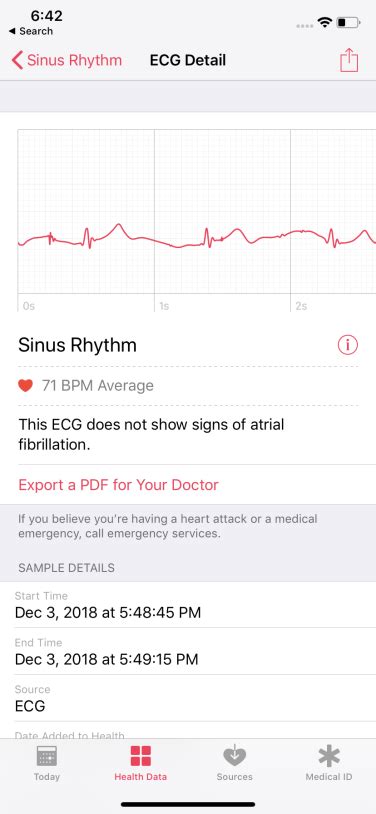 Hands On With Apple Watchs Ecg And Irregular Heart Rhythm Features