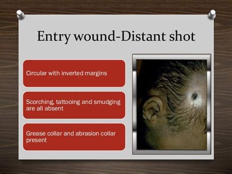 Entry And Exit Wounds