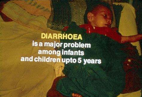 Slide 35 A Simple Solution To Curb The Effects Of Diarrhoea In