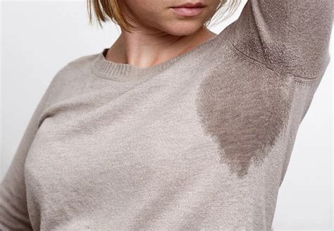 Excessive Sweating Treatments Unique Cosmetic Clinic Richmond Hill
