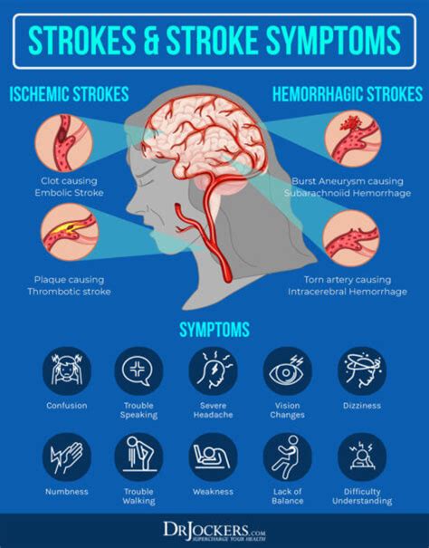 Cerebrovascular Disease Causes Symptoms And Support Strategies