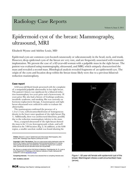 Solution Epidermoid Cyst Of The Breast Mammography Ultrasound Mri
