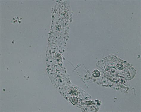 Hyaline Casts In Urine Microscopic Analysis Of Urine Faculty Of