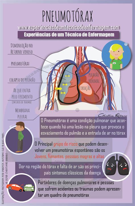 Diagnóstico De Enfermagem Para Pneumonia