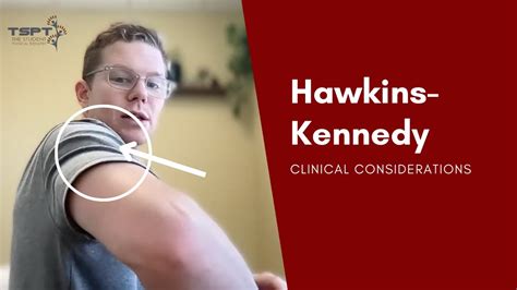 Hawkins Kennedy Clinical Considerations Youtube