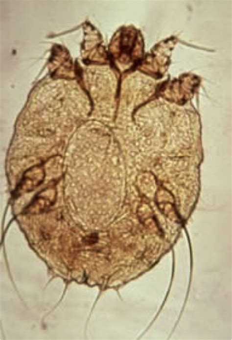 Sarcoptes Scabiei The Itch Mite Is A Parasitic Arthropod That Burrows Into Skin And Causes