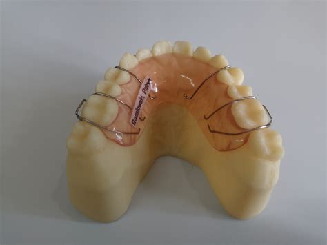 Orthodontic Appliance China Orthodontic