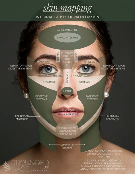 Acne Face Map Skin Mapping Chart Pinpoint Internal Causes Of Problem