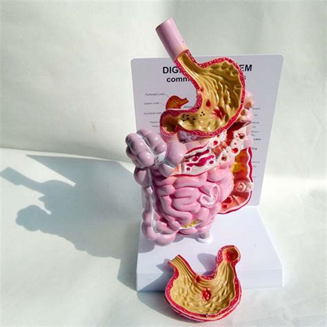 Buy Human Anatomical Anatomy Digestive System Model Life Size