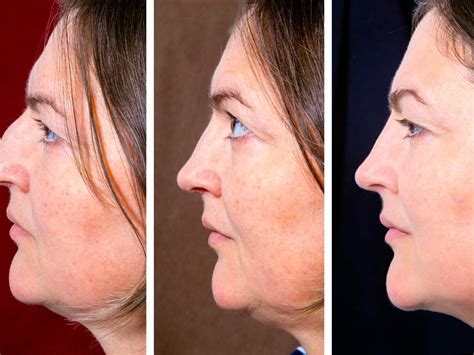 5 Facial Yoga Tips To Get Rid Of Your Double Chin Home Of Life Hacks