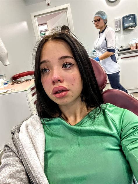 A Woman Sitting In A Dentist Chair With Her Mouth Open And Looking At