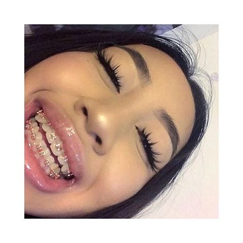 bold beauty collective on instagram “you ever had braces 😁 follow me bold beautycollective