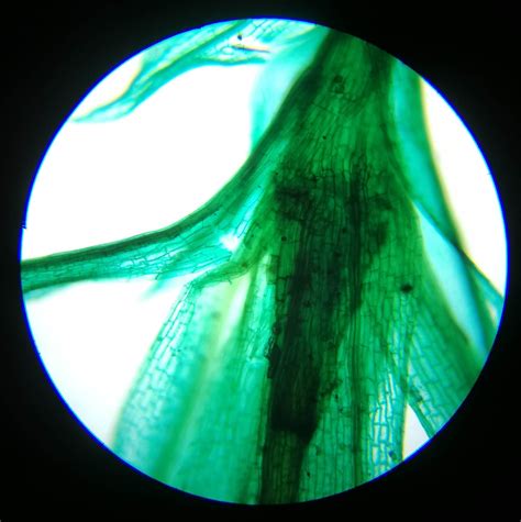 Saxon Pbm Prodigy Ii Biological Microscope 40x 1600x 311006