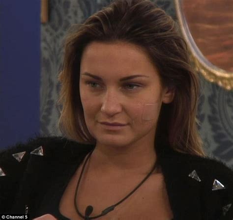 Sam Faiers Suffers Allergic Reaction And Rushed For Medical Treatment