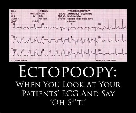 A Little Ecg Humor For My Medical Friends Funny Nurse Quotes