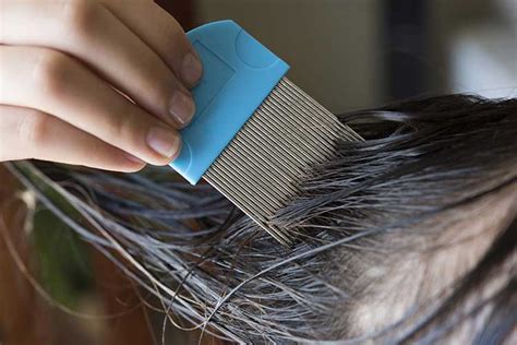 Head Lice What They Are And How To Get Rid Of Them Ausmed