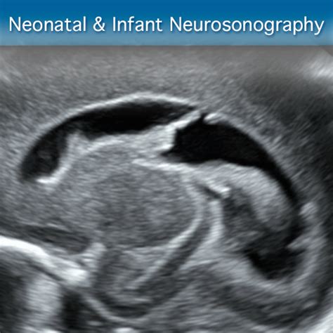 Neonatal And Infant Neurosonography Advanced Clinical Module Sonosim
