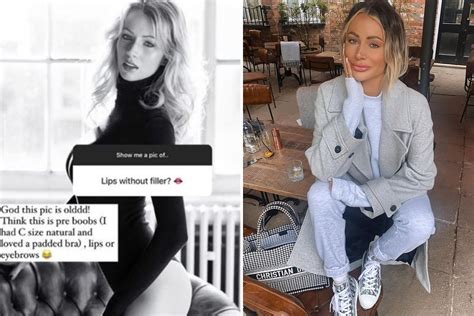 Olivia Attwood Almost Unrecognisable In Pre Surgery Pic Before Lip