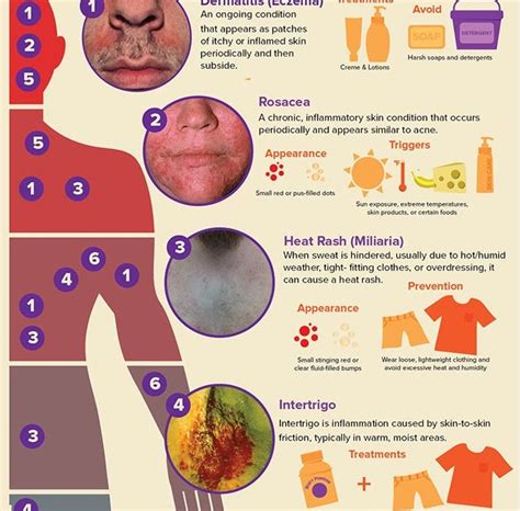 Common Rashes Infographic Skin Itch Rash Recipes Pinterest Images And