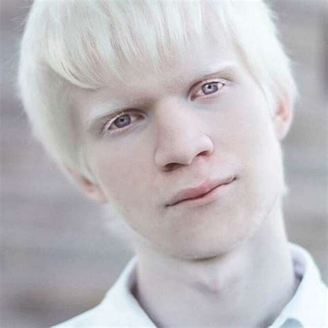 17 Mais Belas Pessoas Albinas Do Mundo