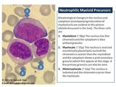 Neutrophilic Myeloid Precursors Hematología Histología Medicina Humana