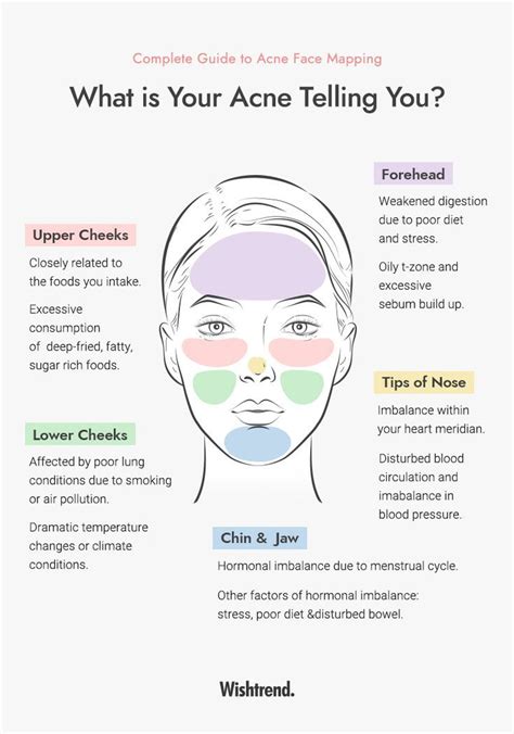 Acne 101 L What Is Acne Telling You Face Mapping Your Acne Face