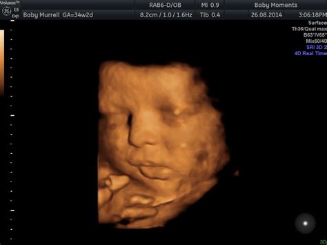 Pin On Amazing 4d Baby Scan Berkshire Call