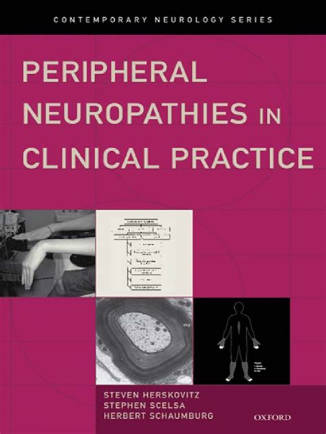 Peripheral Neuropathies In Clinical Practice Pdf Peripheral