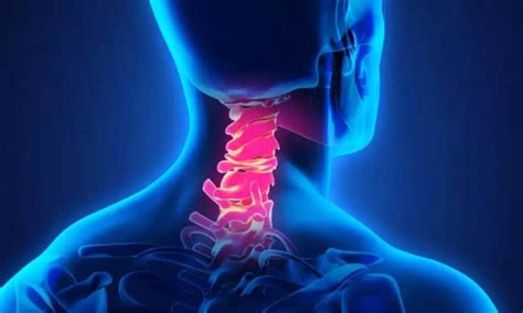 Get Expert Care For Cervical Myelopathy Treatment In Delhi Dr Amit Chugh