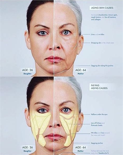 Heres A Look At What Causes Ageing Skin Mondaymotivation Skincare