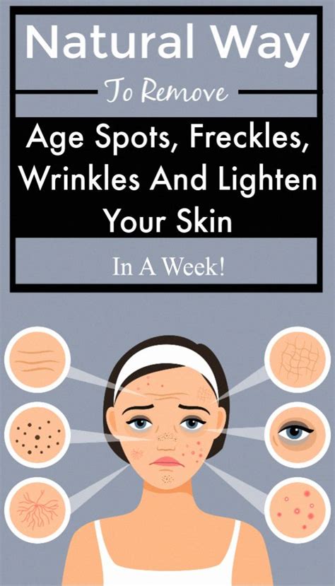 How To Get Rid Of Brown Spots On Experience