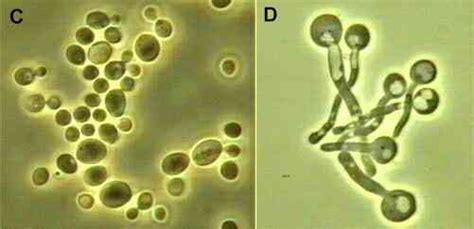 Candida Yeast Under Microscope Micropedia
