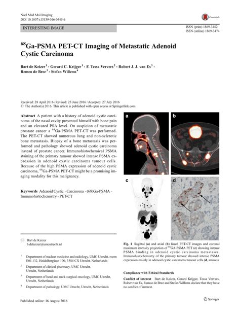 Pdf 68ga Psma Pet Ct Imaging Of Metastatic Adenoid Cystic Carcinoma