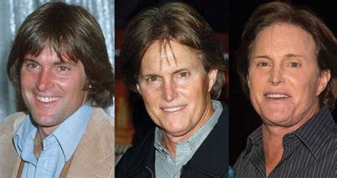 Bruce Jenner Plastic Surgery Before And After Pictures 2020