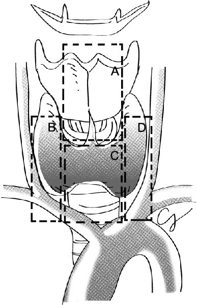 Detailed Anterior View Of The Central Neck Compartment Indicating