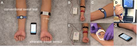 Sweat Test For Cystic Fibrosis Wearable Sweat Sensor Vs Standard