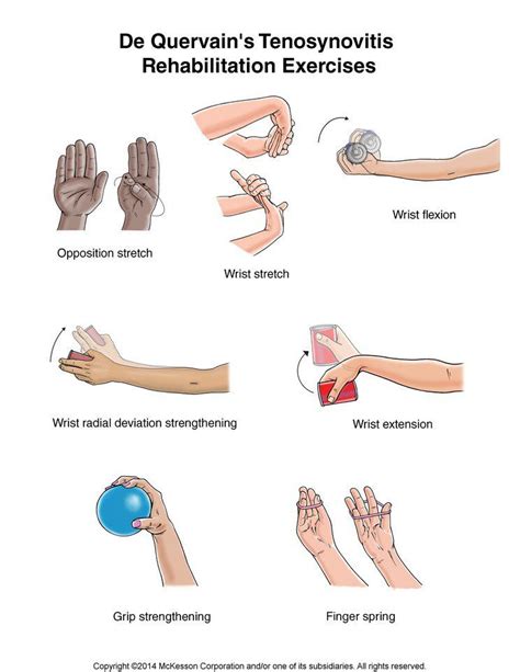 De Quervain S Tenosynovitis Rehab Occupational Therapist Physical