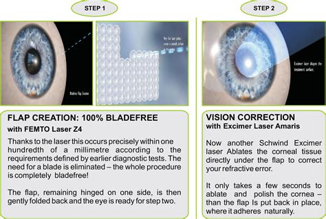 Z Lasik Bladeless Lasik Surgery In Mumbai Doctor Eye Institute