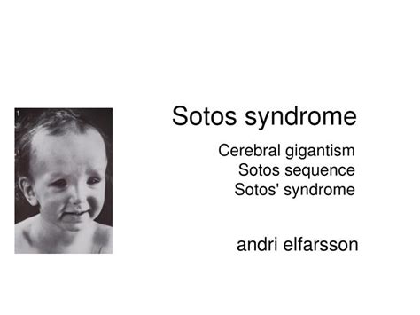 Ppt Sotos Syndrome Powerpoint Presentation Id5478202
