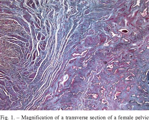 Figure 1 From Histotopographic Study Of The Pubovaginalis Muscle