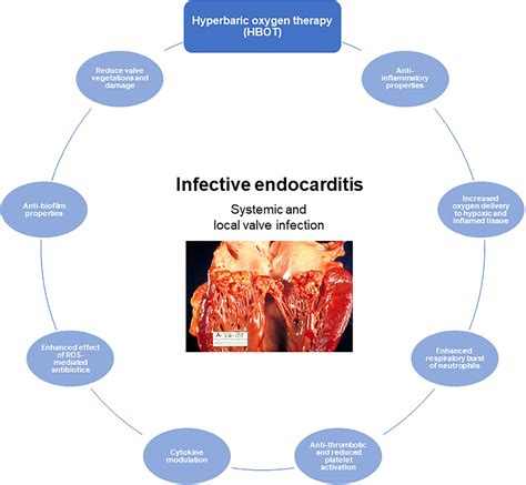 Frontiers Anti Biofilm Approach In Infective Endocarditis Exposes New