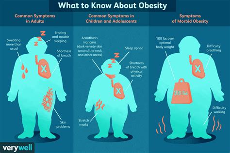 Los S Ntomas De La Obesidad Medicina B Sica