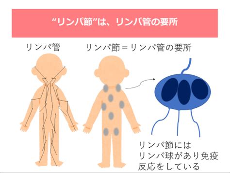 悪性リンパ腫の早期発見のメリットと治療を解説します 多摩北部医療センター 東京都立病院機構