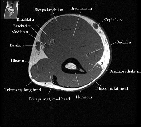 This section of the website will explain. 52 best images about MRI anatomy on Pinterest | Head and ...