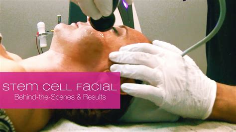 Stem Cell Facial Lifelicious Youtube