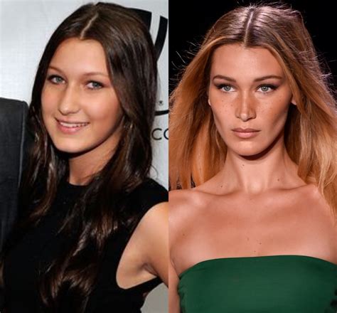 Bella Hadid plastic surgery: Before and after | WHO Magazine