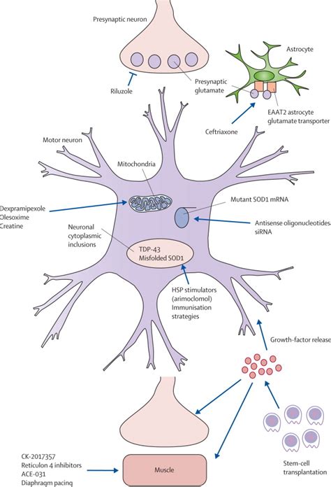 Emerging Targets And Treatments In Amyotrophic Lateral Sclerosis The