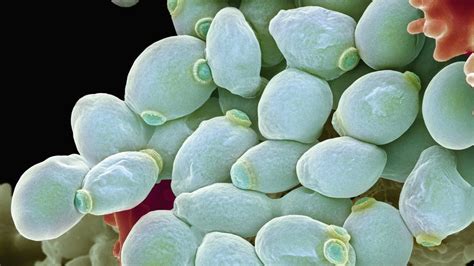 Fungal Infection Threat To Human Health Bbc News