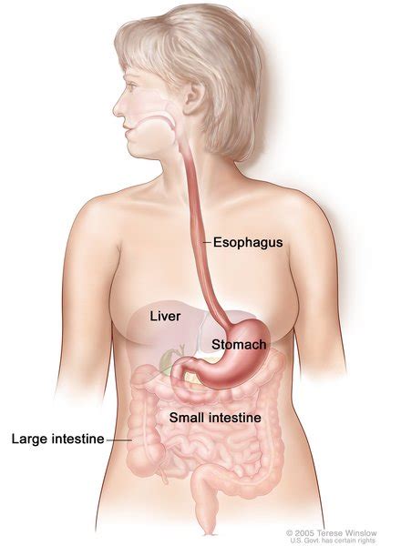 Esophageal Atresia Tracheoesophageal Fistula MedlinePlus Genetics